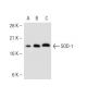 Superoxide Dismutase 1/SOD1 Antibody (72B1) - Western Blotting - Image 42336