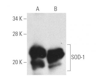 western blotting image from recommended Superoxide Dismutase 1/SOD1 (G-11) monoclonal antibody replacement. Image 3945