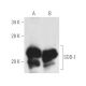 western blotting image from recommended Superoxide Dismutase 1/SOD1 (G-11) monoclonal antibody replacement. Image 3945