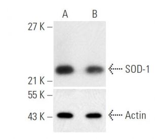 SOD-1 siRNA (h): sc-36523. Western blot analysis of SOD-1 expression in non-transfected control (A) and SOD-1 siRNA transf 