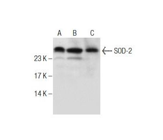 Superoxide Dismutase 2/SOD2 Antibody (18) - Western Blotting - Image 282422
