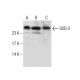 Superoxide Dismutase 2/SOD2 Antibody (18) - Western Blotting - Image 282422