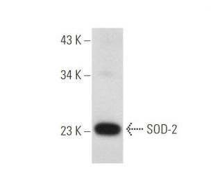 Superoxide Dismutase 2/SOD2 Antibody (24) - Western Blotting - Image 68362