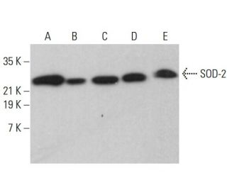 Superoxide Dismutase 2/SOD2 Antibody (A-2) - Western Blotting - Image 380259 