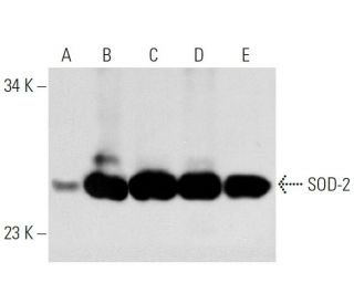 Superoxide Dismutase 2/SOD2 Antibody (B-1) - Western Blotting - Image 54078 
