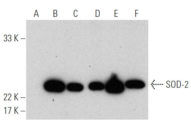 sod-2-antibody-e-10-western-