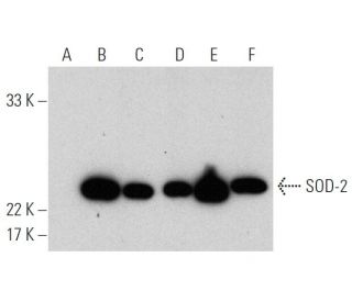 western blotting image from recommended Superoxide Dismutase 2/SOD2 (E-10) monoclonal antibody replacement. Image 366655