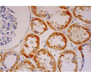 Superoxide Dismutase 3/SOD3 Antibody (4G11G6) - Immunohistochemistry - Image 293359