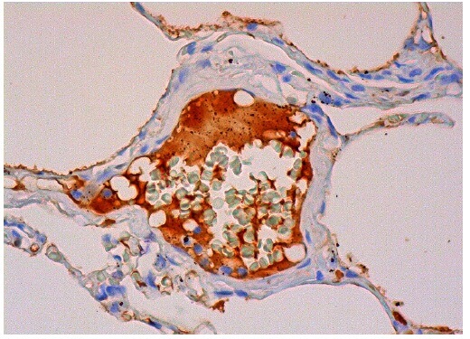 Superoxide Dismutase 3/SOD3 Antibody (A-11) | SCBT - Santa Cruz