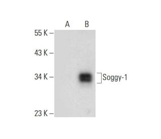 Soggy-1 Antibody (B-4) - Western Blotting - Image 297136