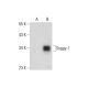Soggy-1 Antibody (B-4) - Western Blotting - Image 297136