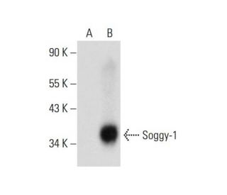 Soggy-1 Antibody (E-12) - Western Blotting - Image 134137