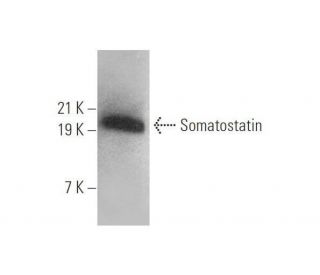 western blotting image from recommended Somatostatin (G-10) monoclonal antibody replacement. Image 352420