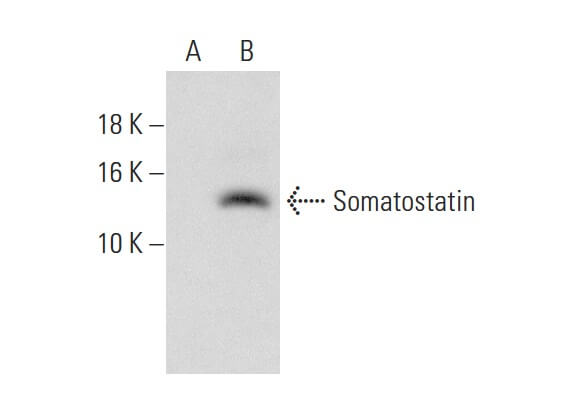 Somatostatin Antibody (G-10) | SCBT - Santa Cruz Biotechnology