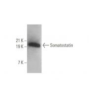 Somatostatin Antibody (G-10) | SCBT - Santa Cruz Biotechnology