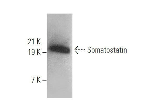 Somatostatin Antibody (G-10) | SCBT - Santa Cruz Biotechnology