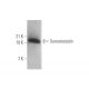 western blotting image from recommended Somatostatin (G-10) monoclonal antibody replacement. Image 352420