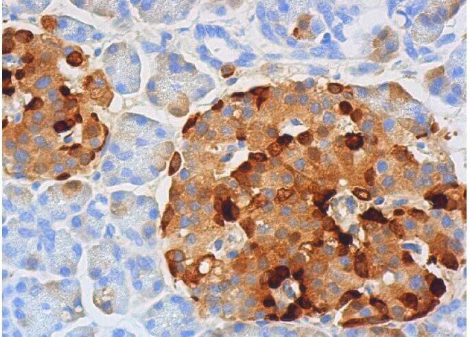 Somatostatin Antibody (H-11) | SCBT - Santa Cruz Biotechnology