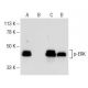 Western blot analysis of ERK phosphorylation in untreated (A,C) and Sorafenib (sc-220125) treated (B,D) SK-MEL-28 whole ce 
