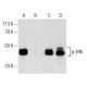 Western blot analysis of ERK phosphorylation in untreated (A,C) and Sorafenib (sc-220125) treated (B,D) SW480 whole cell l