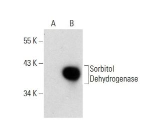 Sorbitol Dehydrogenase Antibody (E-11) - Western Blotting - Image 144804