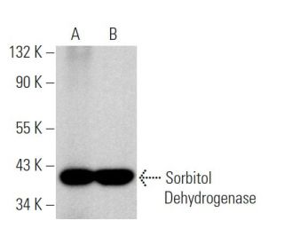Sorbitol Dehydrogenase Antibody (E-8) - Western Blotting - Image 369316 