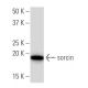 sorcin Antibody (39-M) - Western Blotting - Image 34231