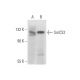 SorCS2 Antibody (A-10) - Western Blotting - Image 304359