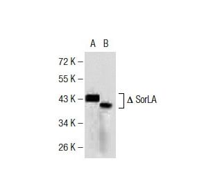western blotting image from recommended SorLA (7D7B11) monoclonal antibody replacement. Image 137457