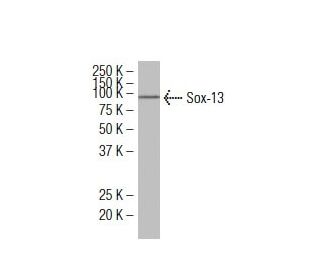 Sox-13 Antibody (C-16) - Western Blotting - Image 34518Each CRISPR/Cas9 Knockout (KO) Plasmid product consists of a pool of 3 plasmids designed to ensure identification and cleavage of a specific gene for maximum knockout efficiency. Each plasmid encodes a unique 20 nt sequence derived from the GeCKO (v2) library.