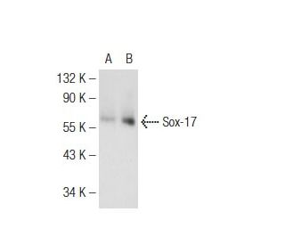 Sox-17 Antibody (3.5CH) - Western Blotting - Image 126754Each CRISPR/Cas9 Knockout (KO) Plasmid product consists of a pool of 3 plasmids designed to ensure identification and cleavage of a specific gene for maximum knockout efficiency. Each plasmid encodes a unique 20 nt sequence derived from the GeCKO (v2) library.