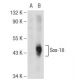 Sox-18 Antibody (E-2) - Western Blotting - Image 108810