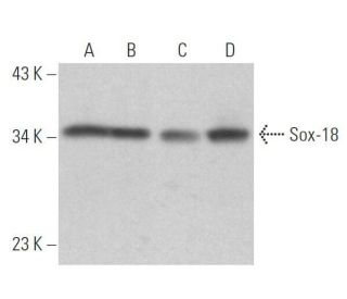 western blotting image from recommended Sox-18 (D-8) monoclonal antibody replacement. Image 358950
