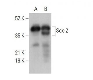 Sox2 Antibody (A-5)