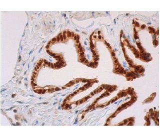 immunohistochemistry image from recommended Sox2 (E-4) monoclonal antibody replacement. Image 355323