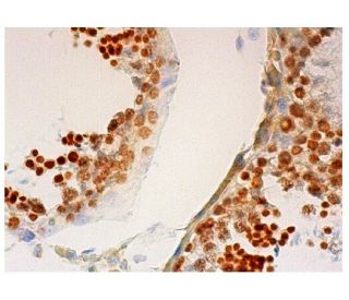 Sox-30 Antibody (G-1) - Immunohistochemistry - Image 301845 