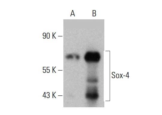 Sox-4 Antibody (B-7) | SCBT - Santa Cruz Biotechnology