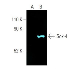 Sox-4 Antibody (B-7)