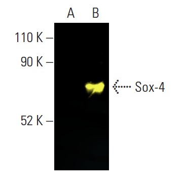 Sox-4 Antibody (B-7) | SCBT - Santa Cruz Biotechnology