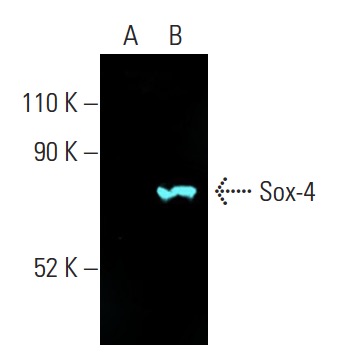 Sox-4 Antibody (B-7) | SCBT - Santa Cruz Biotechnology
