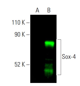 Sox-4 Antibody (B-7) | SCBT - Santa Cruz Biotechnology