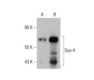western blotting image from recommended Sox-4 (B-7) monoclonal antibody replacement. Image 385677