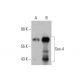 western blotting image from recommended Sox-4 (B-7) monoclonal antibody replacement. Image 385677