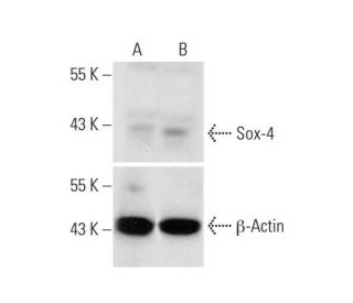 Sox-4 CRISPR Activation Plasmid (h): sc-401217-ACT. Western blot analysis of Sox-4 expression in non-transfected control (SAM Transcription Activation: SAM system utilizing dCas9-VP64, MS2-P65-HSF1, and sgRNA for precise gene transcription activation.