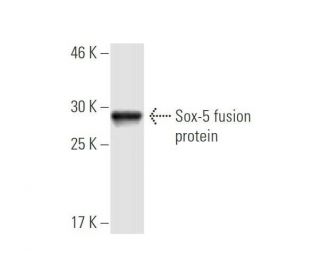 western blotting image from recommended Sox-5 (4H8) monoclonal antibody replacement. Image 348851