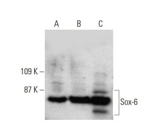 western blotting image from recommended Sox-6 (A-4) monoclonal antibody replacement. Image 386143