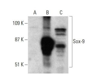 western blotting image from recommended Sox9 (E-9) monoclonal antibody replacement. Image 384304