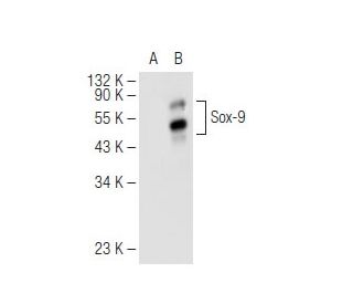 Sox9 Antibody (E-9) | SCBT - Santa Cruz Biotechnology