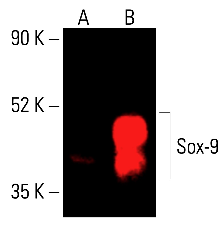 Ｃページ Sox9 Antibody (E-9) | SCBT - Santa Cruz Biotechnology