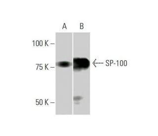 western blotting image from recommended SP-100 (1G6) monoclonal antibody replacement. Image 352144